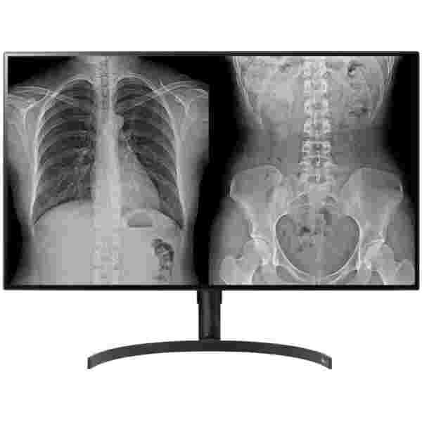 Monitor LG 80 cm (31